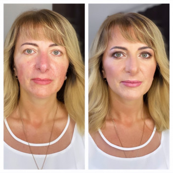 Галина Дзюба, Винница Фото - 5