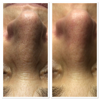 Чистка лица
                    Салон краси Studio Beauty Fox Одеса