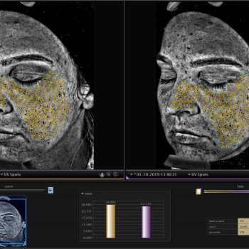 Діагностика шкіри