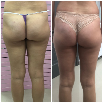 Pink Honey, Дніпро Фото - 59