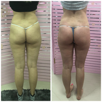 Pink Honey, Дніпро Фото - 61