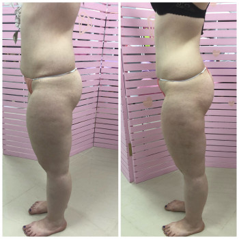 Pink Honey, Дніпро Фото - 64