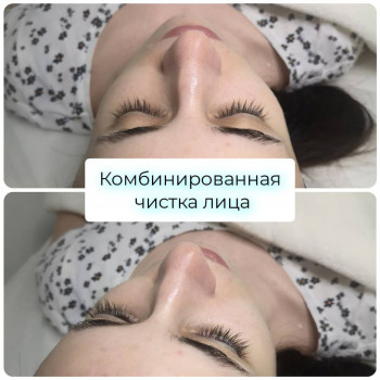 уход за лицом, косметология лица