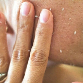 Фото с портфолио Royal Cherry