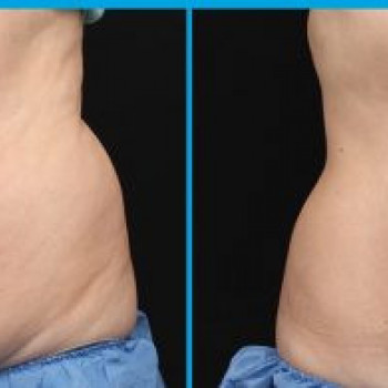 За два сеанси