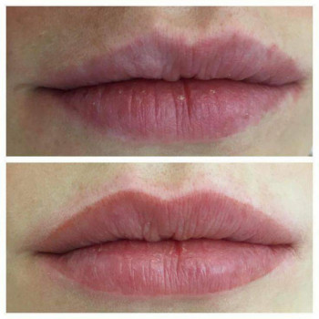 Сніжана Грицюк , Ивано-Франковск Фото - 7