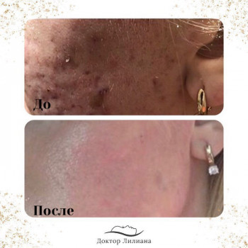 Лечение проблемной кожи
                    Медицинский центр Доктор Лилиана Одесса