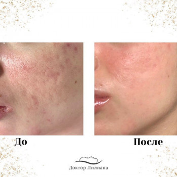 Лечение проблемной кожи
                    Медицинский центр Доктор Лилиана Одесса