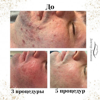 Лечение проблемной кожи
                    Медицинский центр Доктор Лилиана Одесса