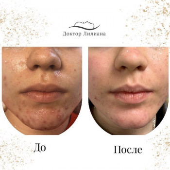 Лечение проблемной кожи
                    Медицинский центр Доктор Лилиана Одесса