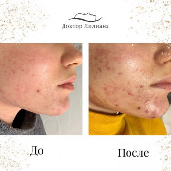 Лечение проблемной кожи
                    Медицинский центр Доктор Лилиана Одесса