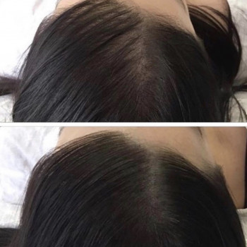 Трихопигментация волос
                    Мастер перманентного макияжа Анастасия Днепр