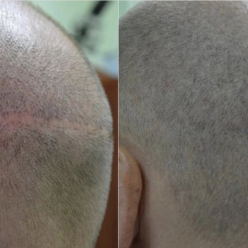 Трихопигментация волос
                    Мастер перманентного макияжа Анастасия Днепр