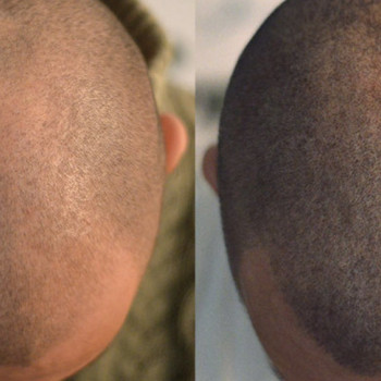 Трихопигментация волос
                    Мастер перманентного макияжа Анастасия Днепр