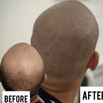 Трихопигментация волос
                    Мастер перманентного макияжа Анастасия Днепр