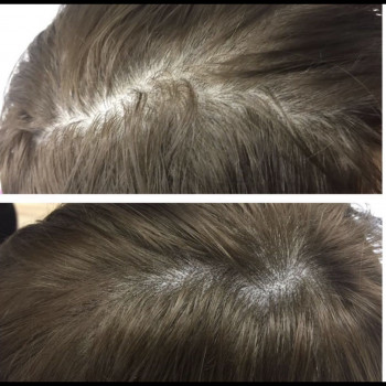 Трихопигментация волос
                    Мастер перманентного макияжа Анастасия Днепр