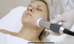 Карбокситерапия Массажный салон Beauty Space Ужгород