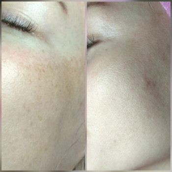 Алина Чернова , Запоріжжя Фото - 8