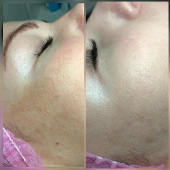 Алина Чернова , Запоріжжя Фото - 7