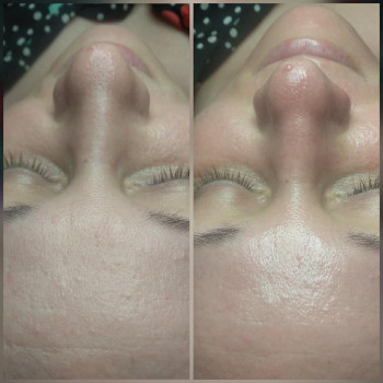 Алина Чернова , Запоріжжя Фото - 4