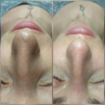 Алина Чернова , Запоріжжя Фото - 3