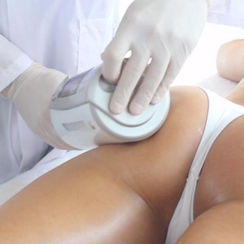 Фото с портфолио Beauty Laser & EndoSpheres Therapy