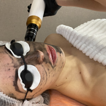 Карбоновий пілінг
                    Мастер перманентного макияжа Олена Леган Львов