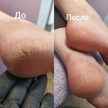 Pudra House, Буча Фото - 9