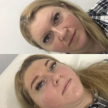 Алина Тимошенко , Суми Фото - 7