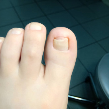 Катерина Діряба, Запоріжжя Фото - 29