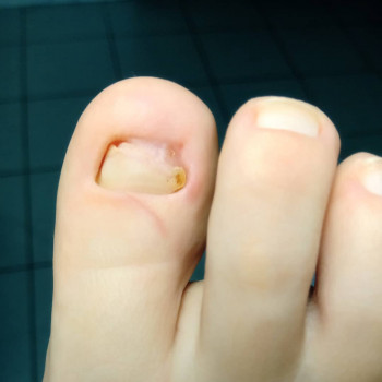 Катерина Діряба, Запоріжжя Фото - 30