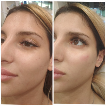 Олеся Ковшова, Днепр Фото - 7