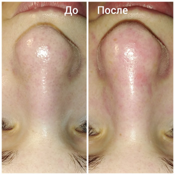 Тетяна Стуканова, Кам'янське Фото - 13