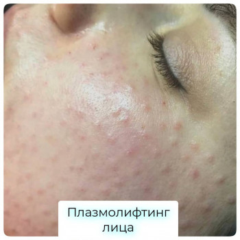 уход за лицом, массаж лица, коррекция морщин, косметология лица