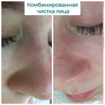 GENETIX, Одесса Фото - 20