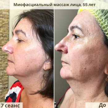 Буккальный & Миофасциальный массаж лица, шеи и головы
                    Косметолог Жанна Київ