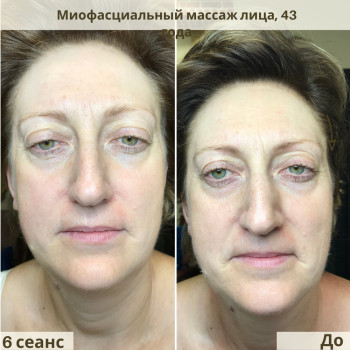 Буккальный & Миофасциальный массаж лица, шеи и головы
                    Косметолог Жанна Київ