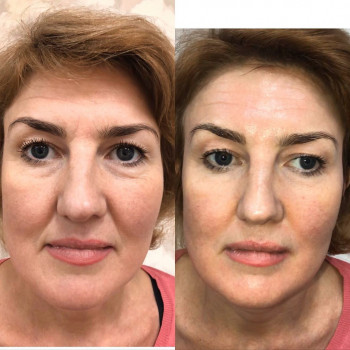 А ведь кожа лица – это как платье,?данное нам природой.