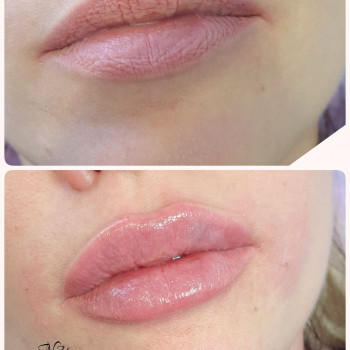 Наталья Еременко, Суми Фото - 25