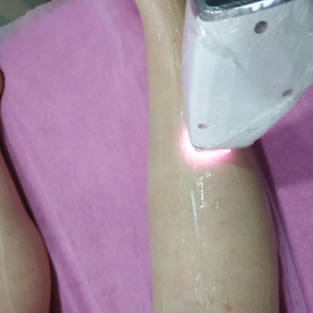 Лазерная эпиляция
                    Мастер депиляции Татьяна Анатольевна Каменское