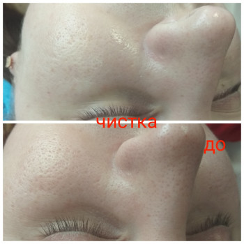 Тетяна Вінник, Вінниця Фото - 16