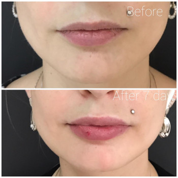 Ксенія Недолуженко, Ужгород Фото - 17