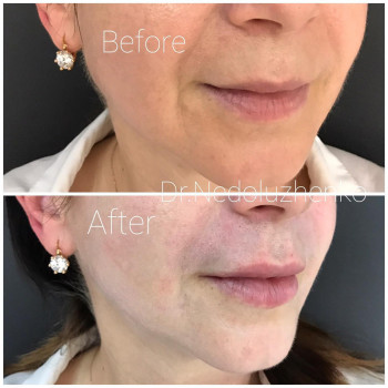 Ксенія Недолуженко, Ужгород Фото - 32