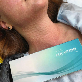 Біорепарація обличчя шиї декольте
                    Лікар-косметолог Юлия Харків