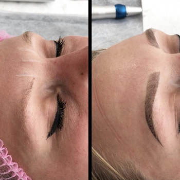 Пудровые брови
                    Майстер перманентного макіяжу Анна Одеса