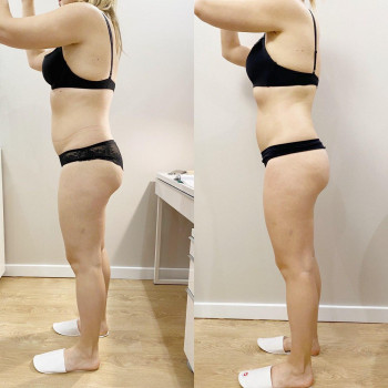 Фото з портфоліо майстра Анастасія Макарова (масажист, Львів)