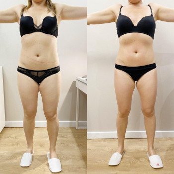 Фото з портфоліо майстра Анастасія Макарова (масажист, Львів)