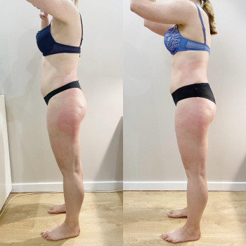 Фото з портфоліо майстра Анастасія Макарова (масажист, Львів)