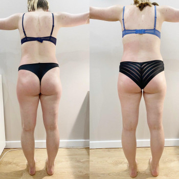 Фото з портфоліо майстра Анастасія Макарова (масажист, Львів)