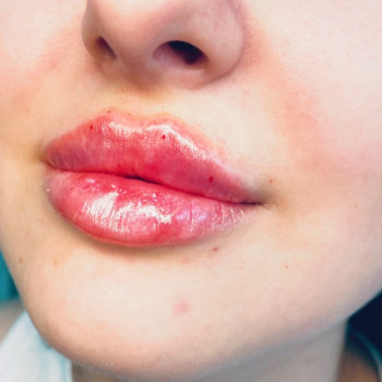 Виктория Врублевская, Вінниця Фото - 25